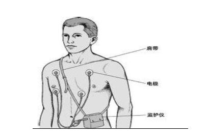 可穿戴医疗设备市场潜力巨大 2017年将达125